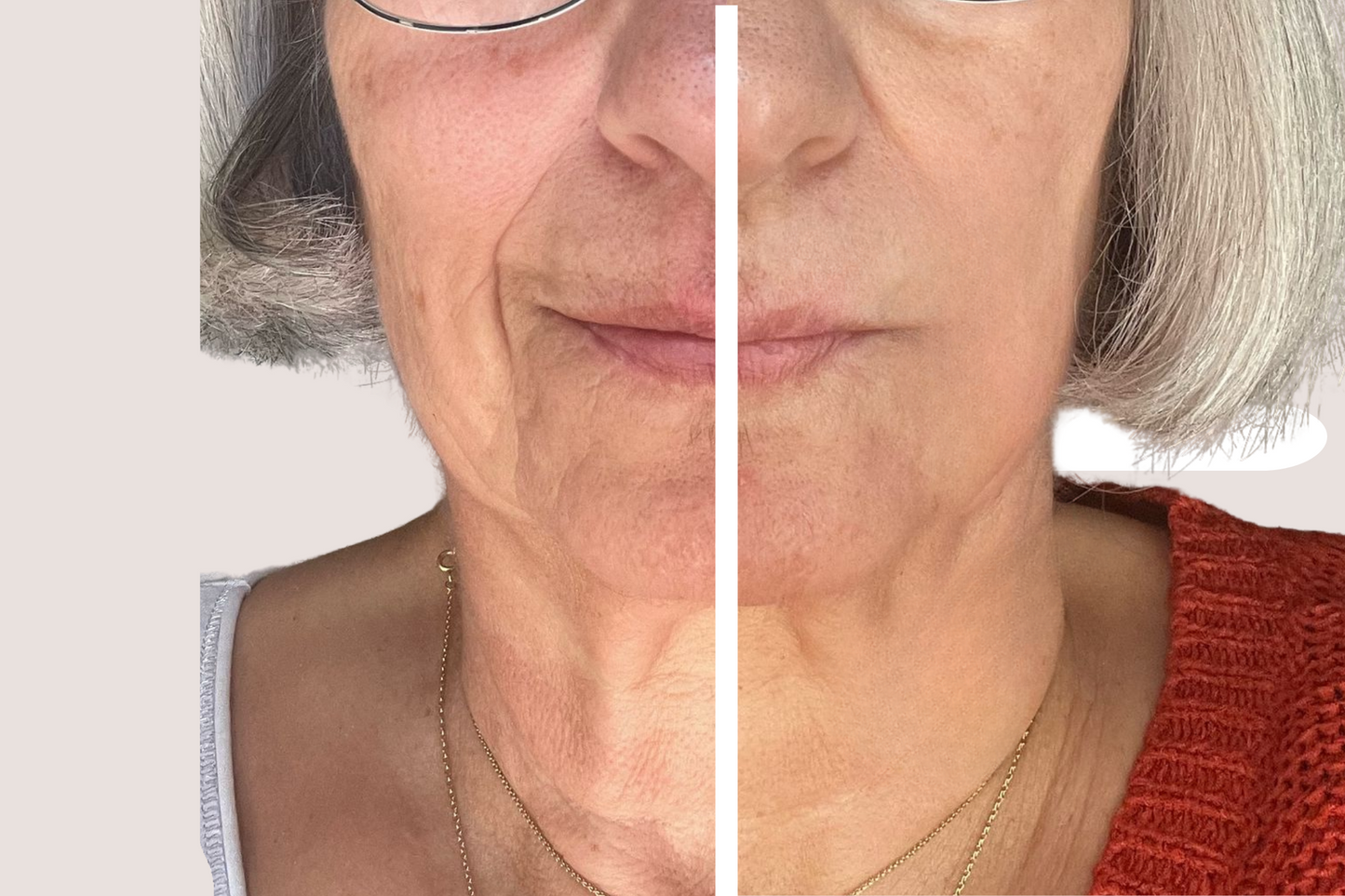 💕 Offre Duo Collagène – Prenez soin de vous en double !